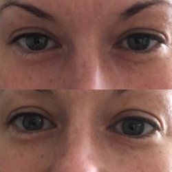 Endure Beauty - Under Eye Therapy Pads Awakening Formula - 5-pack