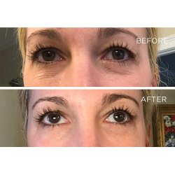 Endure Beauty - Under Eye Therapy Pads Awakening Formula - 5-pack