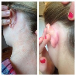 TURBLISS - Bioactive Peat mask - problem skin 150ml