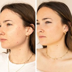 endro cosmtiques - Serum - anti-imperfections