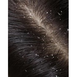 Nurme - Peat Shampoo - Scalp Soothing 